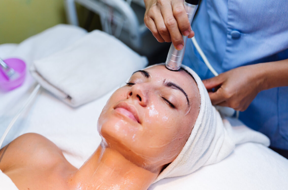 Melasma - Peeling químico - Clínicas de estética en Madrid