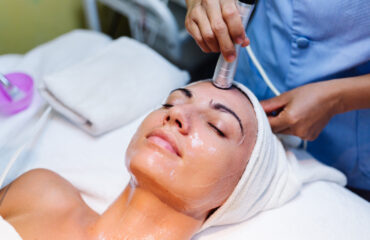 Melasma - Peeling químico - Clínicas de estética en Madrid