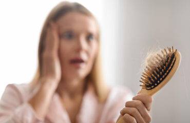 Alopecia en mujeres - Centro Europeo de Cirugía Estética