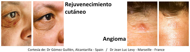 Disfruta de tu apariencia sin limitaciones