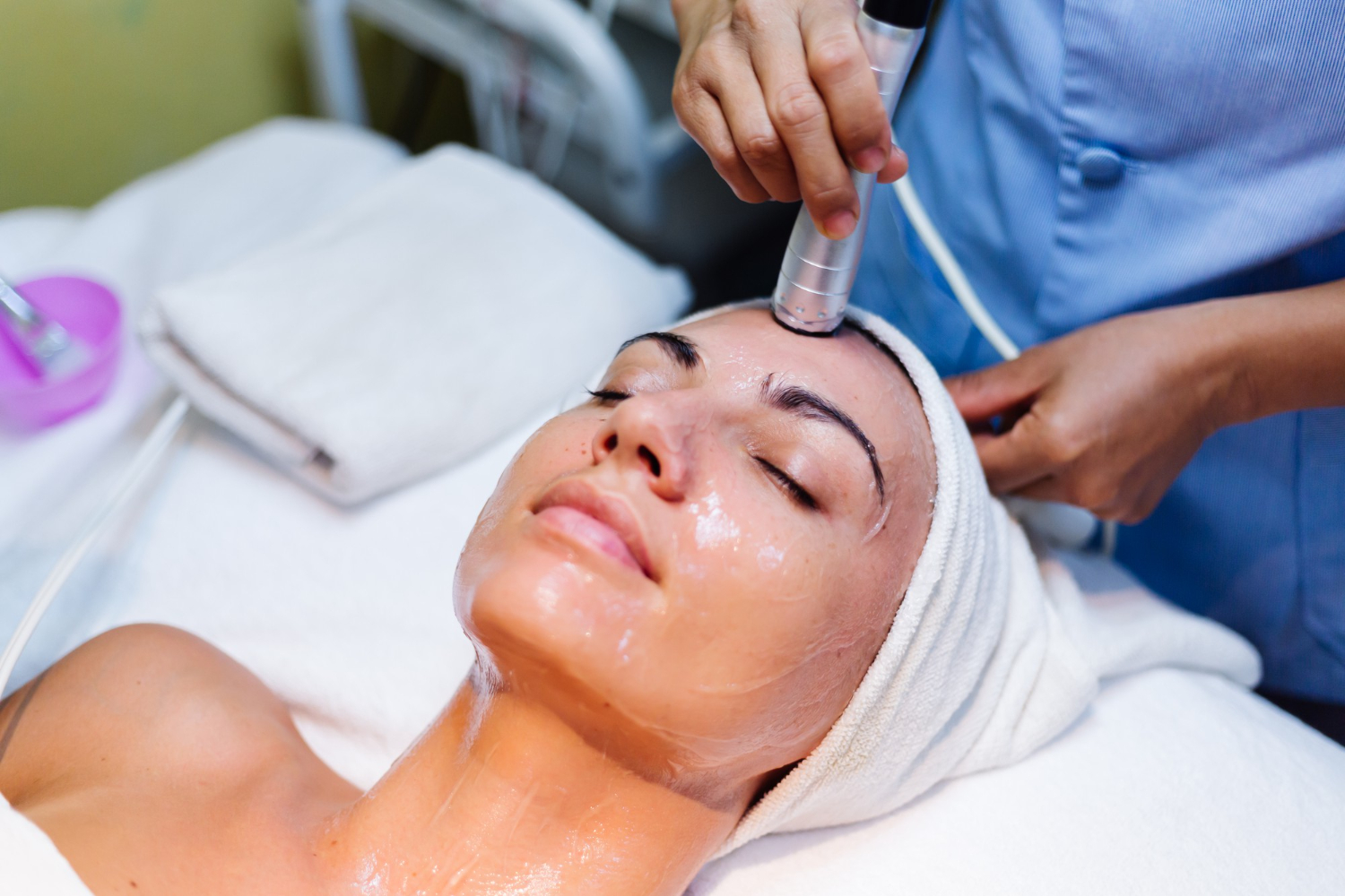 Melasma - Peeling químico - Clínicas de estética en Madrid