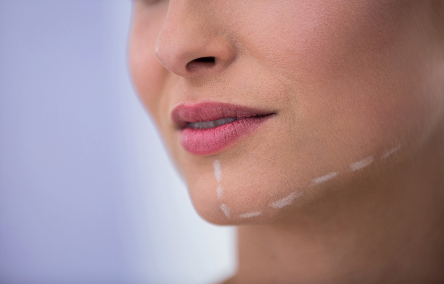 Implantes faciales - Clinica plastica y estetica en madrid