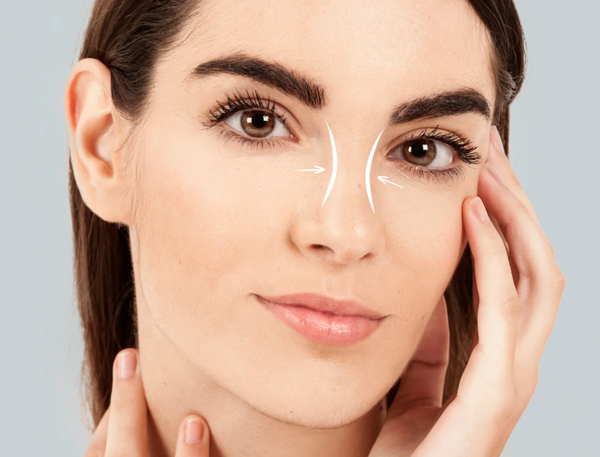 rinoplastia en Granada