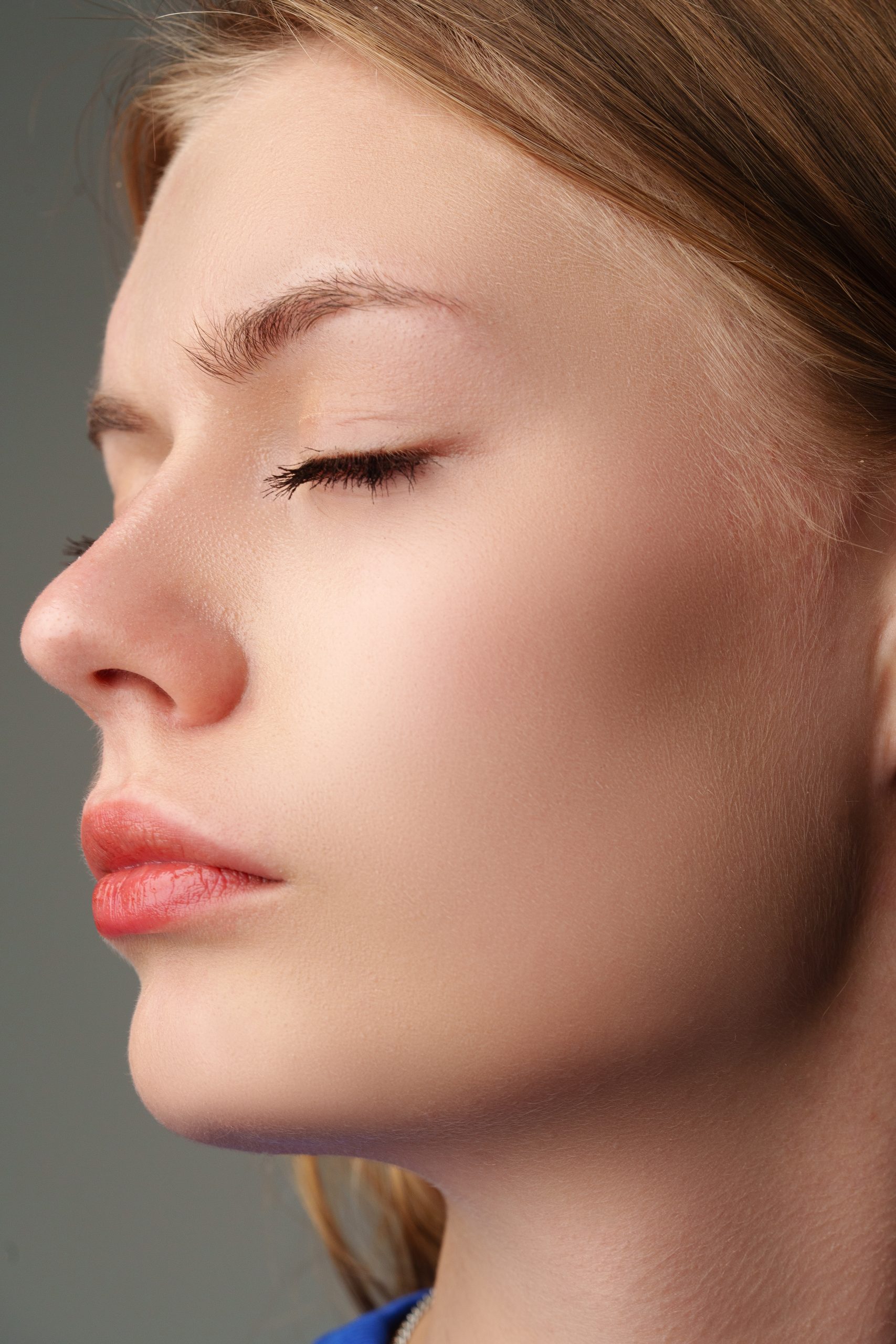 resultados de la rinoplastia