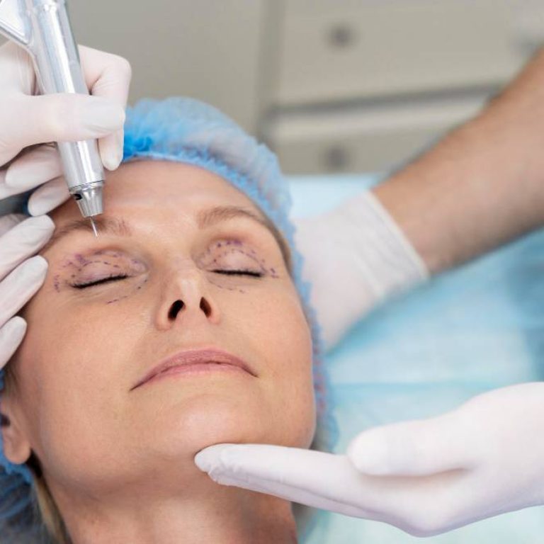 Cuidados tras una blefaroplastia - Centro Europeo de Cirugía Estética