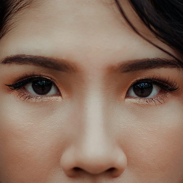 Definir la nariz sin cirugía - Rinomodelación