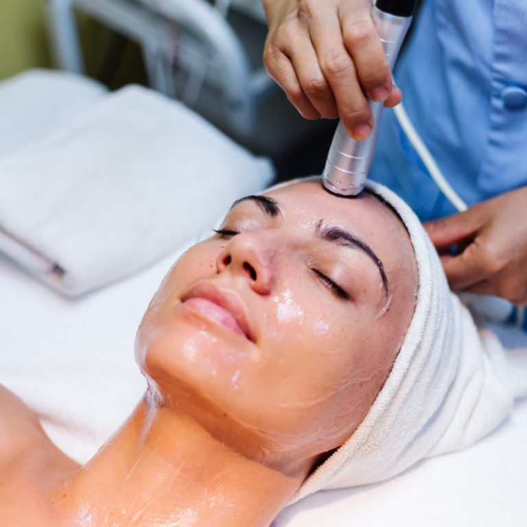 Melasma - Peeling químico - Clínicas de estética en Madrid