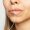 Cómo cuidarse tras un aumento de labios