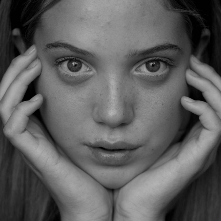 peeling de fenol y el peeling de AHAs