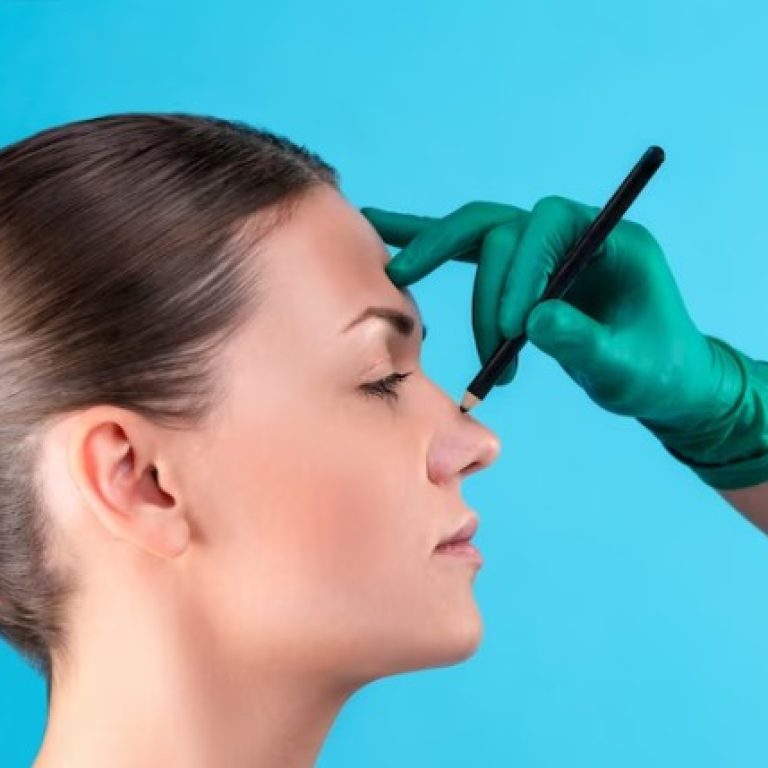 Rinoplastia ultrasónica - Centro Europeo de Cirugía Estética