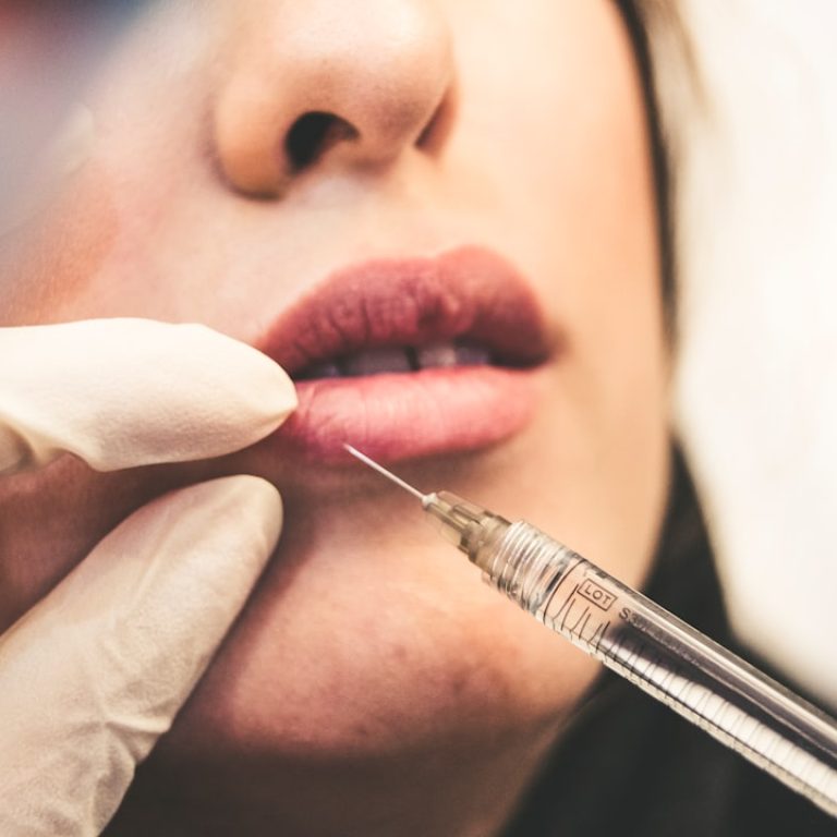 cuanto-dura-aumento-labios