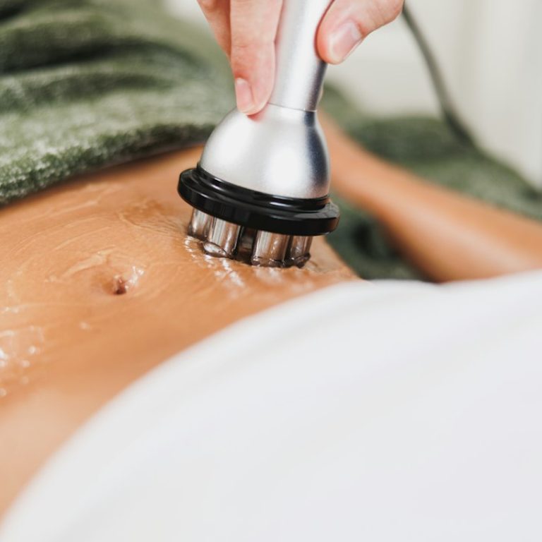 hidrolipoclasia-que-es-como-funciona